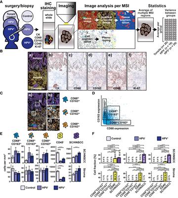 Association between spatial distribution of leukocyte subsets and clinical presentation of head and neck squamous cell carcinoma